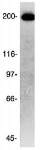 Anti-ATOX1 Rabbit Polyclonal Antibody