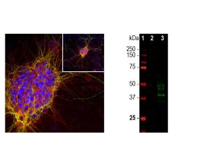 Left: Doublecortin expression (red) in cortical neuron-glial cell culture from E20 rat. Green: MAP2 (C-1382-50). Right: WB of doublecortin expression in rat brain. [1] protein standard, [2] adult brain, [3] embryonic E20 brain. 40 kDa and 45 kDa bands correspond to doublecortin.