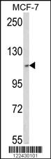 Anti-SKIV2L2 Rabbit Polyclonal Antibody