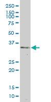 Anti-BOLL Mouse Monoclonal Antibody [clone: 1C3]