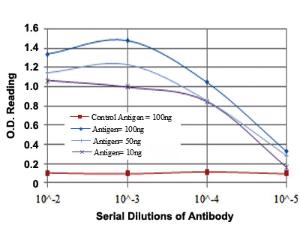 Anti-ATM Mouse Monoclonal Antibody [clone: 5C5]