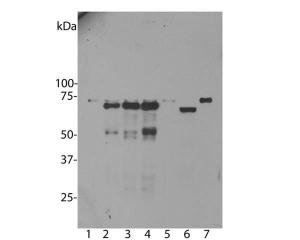 WB of untransfected primary mouse neuron and glia cells (lane 1), the same cells transduced with human ubiquilin 2 wild type (lane 2), with ubiquilin 2 P506T mutant (lane 3), with ubiquilin 2 P497S mutant (lane 4), with enchanced GFP control (lane 5), in HeLa cells (lane 6) and 3T3 cells (lane 7).