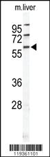 Anti-HABP2 Rabbit Polyclonal Antibody