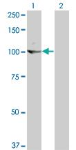 Anti-KIT Mouse Monoclonal Antibody [clone: 6F2]