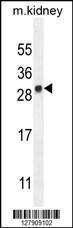 Anti-LYPD4 Rabbit Polyclonal Antibody (HRP (Horseradish Peroxidase))