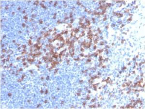 Immunohistochemical analysis of formalin-fixed, paraffin-embedded human lymph node using Anti-CD8A Antibody [C8/468]