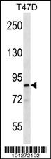 Anti-MARK1 Rabbit Polyclonal Antibody