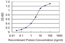 Anti-KIT Mouse Monoclonal Antibody [clone: 6F2]