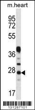 Anti-CRYBA1 Rabbit Polyclonal Antibody (Biotin)