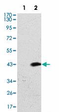 Anti-ATM Mouse Monoclonal Antibody [clone: 5C5]