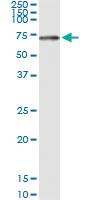 Anti-STK33 Polyclonal Antibody Pair