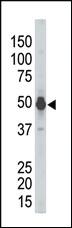 Anti-ALDH3A2 Mouse Monoclonal Antibody