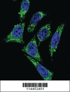 Anti-MDK Rabbit Polyclonal Antibody