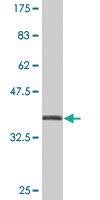 Anti-ZNF461 Mouse Monoclonal Antibody [clone: 4G11]