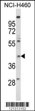 Anti-FPR3 Rabbit Polyclonal Antibody (AP (Alkaline Phosphatase))