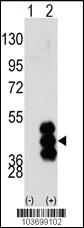 Anti-ALDH3A2 Mouse Monoclonal Antibody