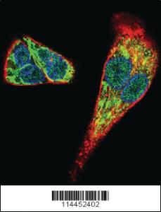 Anti-MDK Rabbit Polyclonal Antibody