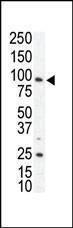 Anti-AXL Rabbit Polyclonal Antibody (FITC (Fluorescein Isothiocyanate))