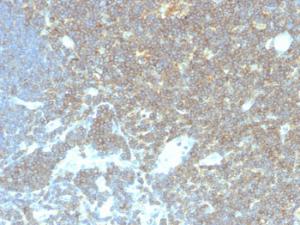 Immunohistochemical analysis of formalin-fixed, paraffin-embedded human lymph node tissue using Anti-CD48 Antibody [CD48/4786]