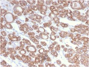 Anti-Cytokeratin 18 Rabbit Recombinant Antibody [clone: KRT18/2808R]