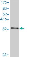 Anti-DIRAS3 Mouse Polyclonal Antibody