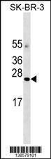 Anti-AGTRAP Rabbit Polyclonal Antibody (HRP (Horseradish Peroxidase))