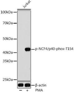 Western blot analysis of extracts of Jurkat cells, using Anti-p40-phox (phospho Thr154) Antibody (A308237) at 1:1,000 dilution. Jurkat cells were treated by PMA/TPA (200 nM) at 37°C for 10 minutes. The secondary antibody was Goat Anti-Rabbit IgG H&L Antibody (HRP) at 1:10,000 dilution.