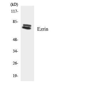 Western blot analysis of the lysates from COLO205 cells using Anti-Ezrin Antibody