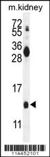 Anti-MDK Rabbit Polyclonal Antibody