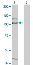 Anti-KIT Mouse Monoclonal Antibody [clone: 1G1]