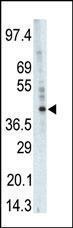 Anti-Phosphorylase Kinase Subunit gamma 1 Rabbit Polyclonal Antibody (AP (Alkaline Phosphatase))