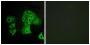 Immunofluorescence analysis of A549 cells using Anti-EDG6 Antibody. The right hand panel represents a negative control, where the Antibody was pre-incubated with the immunising peptide