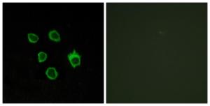 Immunofluorescence analysis of COS7 cells using Anti-FZD5 Antibody The right hand panel represents a negative control, where the antibody was pre-incubated with the immunising peptide