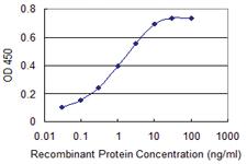 Anti-KIT Mouse Monoclonal Antibody [clone: 1G1]