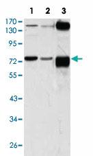 Anti-ATP2C1 Mouse Monoclonal Antibody [clone: 4G12]