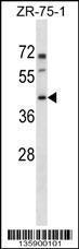 Anti-PANX3 Rabbit Polyclonal Antibody (HRP (Horseradish Peroxidase))