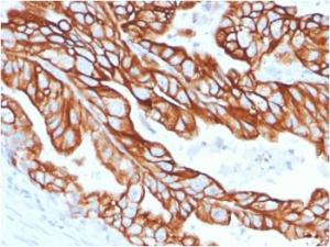 Anti-Cytokeratin 18 Rabbit Recombinant Antibody [clone: KRT18/2808R]