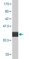 Anti-CLIC5 Mouse Monoclonal Antibody [clone: 1E6]