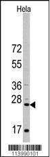 Anti-CD8A Rabbit Polyclonal Antibody (FITC (Fluorescein Isothiocyanate))