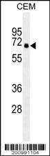 Anti-PRKAA2 Mouse Monoclonal Antibody (PE (Phycoerythrin)) [clone: 206CT5.4.2]