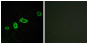 Anti-HTR5A antibody