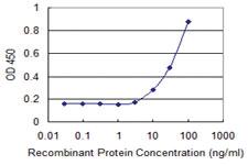 Anti-COL9A1 Mouse Monoclonal Antibody [clone: 3H1]