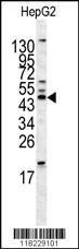 Anti-Homer 1 Rabbit Polyclonal Antibody