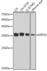 Western blot analysis of extracts of various cell lines, using Anti-PITX3 / PTX3 Antibody [ARC2429] (A307222) at 1:1,000 dilution. The secondary antibody was Goat Anti-Rabbit IgG H&L Antibody (HRP) at 1:10,000 dilution.