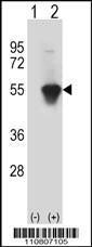 Anti-MINA Rabbit Polyclonal Antibody (FITC (Fluorescein))