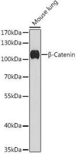 Western blot analysis of extracts of Mouse lung, using Anti-beta Catenin Antibody (A12611) at 1:1000 dilution