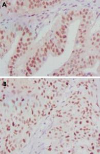 Anti-ATP2C1 Mouse Monoclonal Antibody [clone: 4G12]