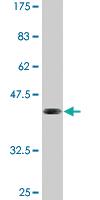 Anti-ELF5 Mouse Monoclonal Antibody [clone: 3D10]