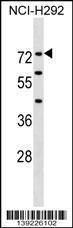 Anti-F12 Rabbit Polyclonal Antibody (FITC (Fluorescein Isothiocyanate))