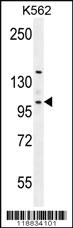 Anti-VILL Rabbit Polyclonal Antibody